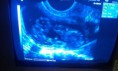 /album/photogallery/a2013-0211-evening-sunbeam-bengal-caz-bengal-katzen-ultrasound-test-kitten-3-1-jpg/